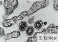 図1 FeLVのウイルス粒子電子顕微鏡写真